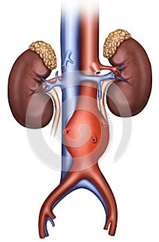 Aneurisma aÃÂ³rtico abdominal photo