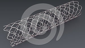 Angioplasty Stent