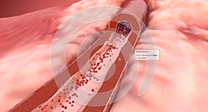 Angiotensin II Receptor Blockers, Decreased Blood Pressure