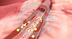 Angiotensin II Receptor Blockers, Decreased Blood Pressure