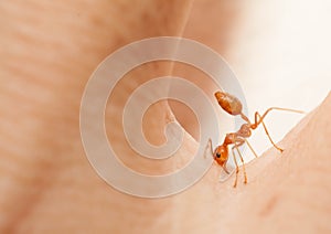 Angry ant attack by bite and spray citric acid