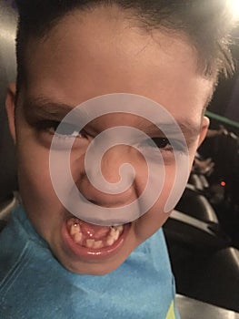 Angry boy missing teeth