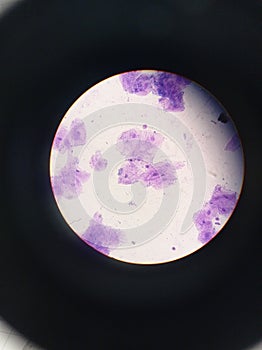 Animal eukaryotic cell. Bucal epitelium mucose cells. Painted purple, seen in an optic microscope. photo