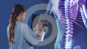 Animation of a doctor holding a x-ray scan over a 3D human body model spinning on blue background.
