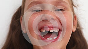 Animation of laughing, playful blond little girl smiling camera with toothless mouth. Fast, easy treatment for children