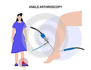 Ankle arthroscopy poster photo