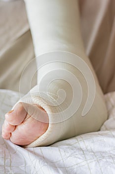 Ankle cast on an elderly person. photo