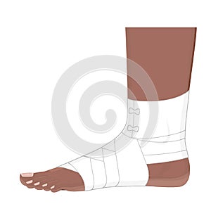 An Ankle with Elastic bandage_Lateral view of Aframerican human