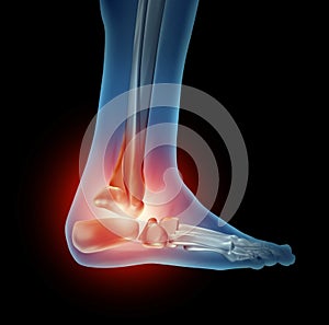 Ankle Foot Pain