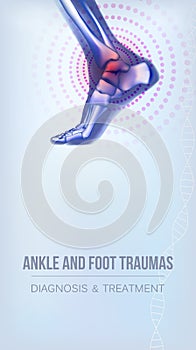 Ankle and foot traumas banner