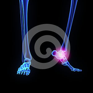 Ankle joint photo