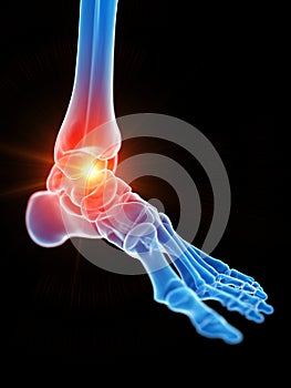 the ankle joint showing pain