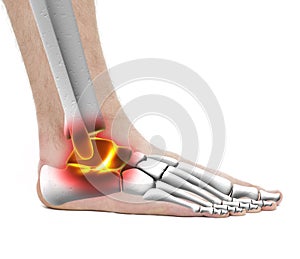 Ankle Pain Injury - Anatomy Male - Studio photo isolated on whit