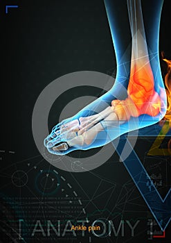 Ankle pain by x- ray on background