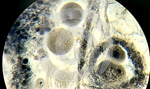 Anodonta eggs, microscopic photo of permanent preparation