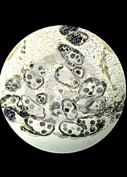 Anodonta eggs, microscopic photo of permanent preparation