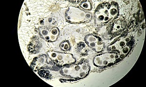 Anodonta eggs, microscopic photo of permanent preparation