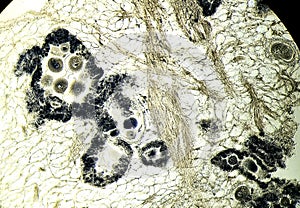 Anodonta eggs, microscopic photo of permanent preparation