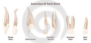 Anomalies of teeth roots. Adult human teeth, molar premolar canine incisor photo
