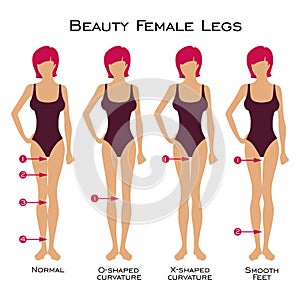 Ð¡anon of beauty of female legs is 4 gaps in the silhouette of the legs. Set of silhouette of a female figure. Types of curvature