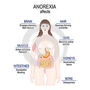 Anorexia nervosa is an eating disorder. low weight. Anorexia affects