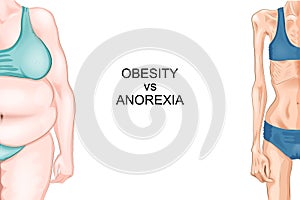 Anorexia and obesity