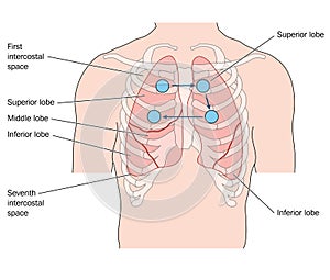 Anterior lung auscultation sites