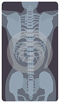 Anterior radiograph of human rib cage and pelvis. X-ray picture or radiographic image of bones and joints, front view