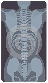 Anterior radiograph of human rib cage and pelvis. X-ray picture or radiographic image of bones and joints, front view photo