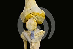 Antero posterior view of articulated femur tibia fibula patella bones showing human knee joint anatomy in isolated black backgroun