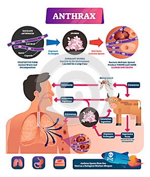 Antrax vektor ilustrace. označený zdravotní infekce nemoc cyklus systém 