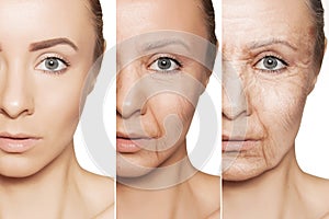 Anti-aging procedures on caucasian woman face