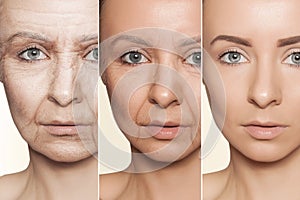 Anti-aging procedures on caucasian woman face photo