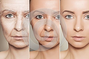 Anti-aging procedures on caucasian woman face photo