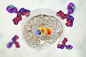 Anti-basal ganglia antibodies. 3D conceptual illustration