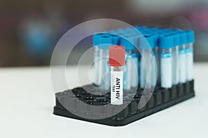 Anti HIV laboratory test photo