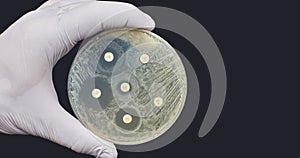 Antibiogram Kirby Bauer Antimicrobial susceptibility resistance diffusion test