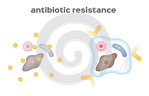 Antibiotic resistance bacteria and virus
