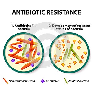 Antibiotic resistance photo