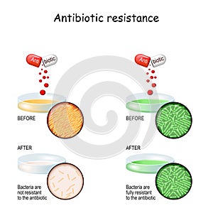 Antibiotic resistance. Experiment