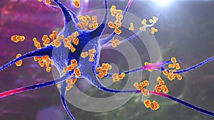 Antibodies attacking neuron photo