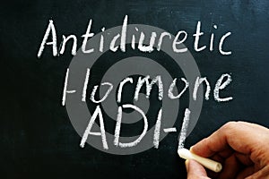 Antidiuretic hormone ADH or vasopressin sign