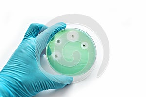 Antimicrobial susceptibility test