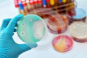 Antimicrobial susceptibility test