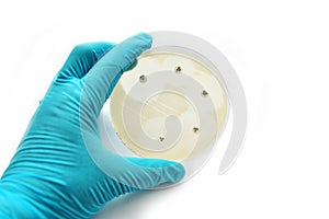 Antimicrobial susceptibility test