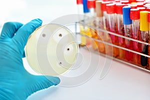 Antimicrobial susceptibility test