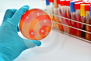 Antimicrobial susceptibility test