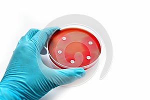 Antimicrobial susceptibility test