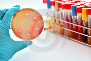 Antimicrobial susceptibility test