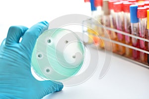 Antimicrobial susceptibility test